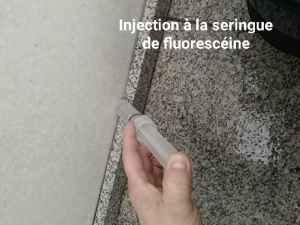 injection seringue fluoresceine